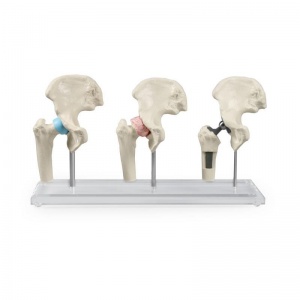 Erler-Zimmer Hip Joints Model (Set of 3)